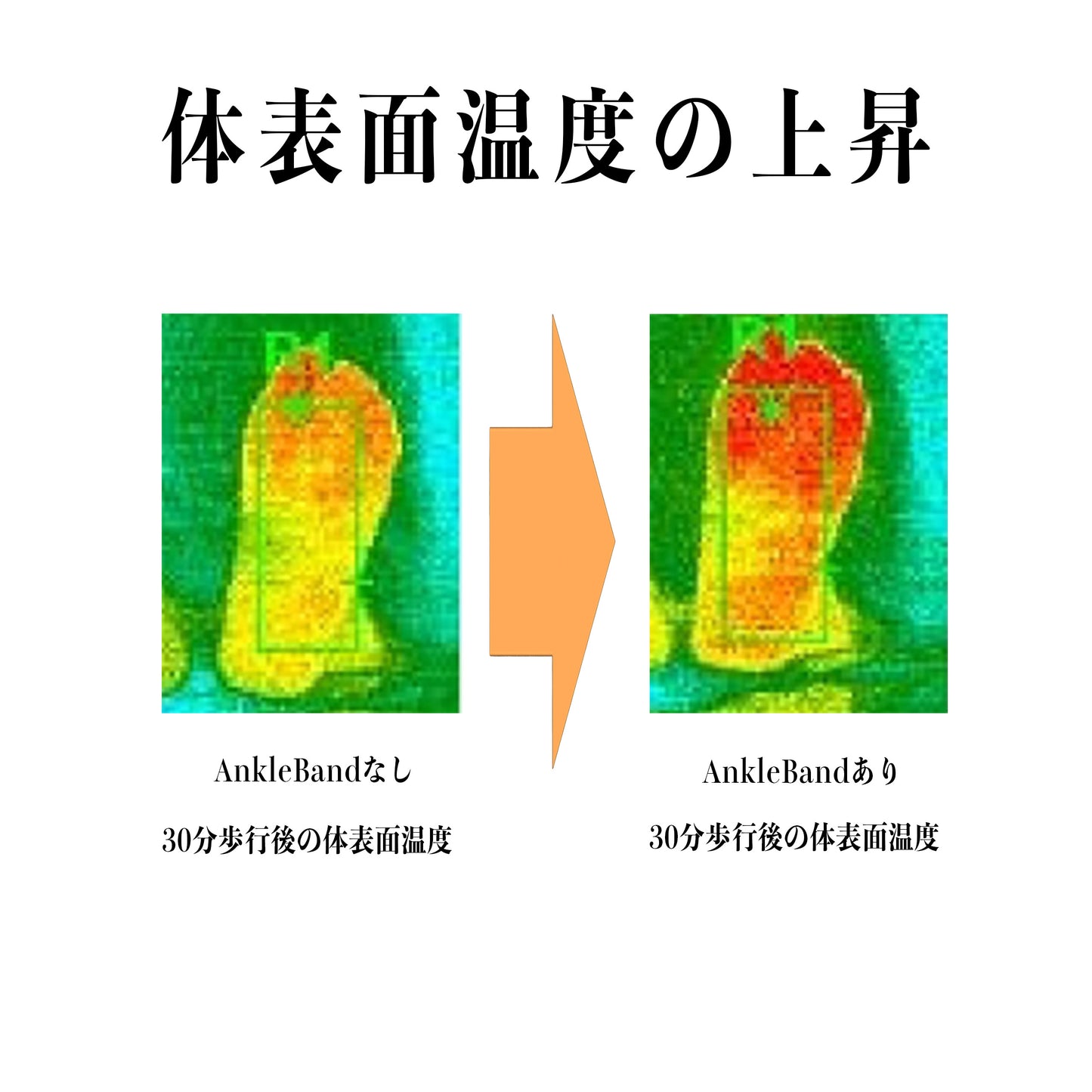 AnkleBand 【片足のみ】color:黒