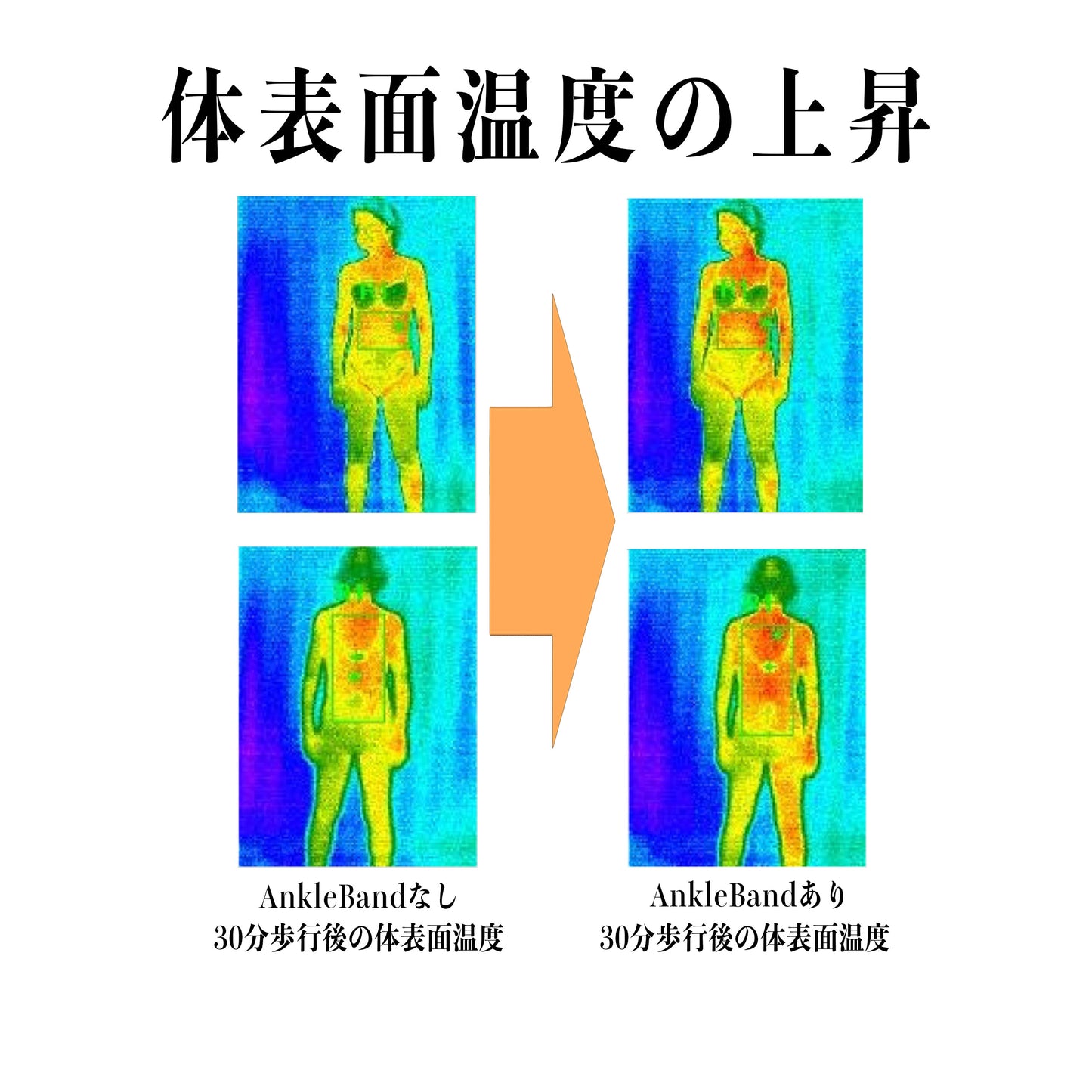 AnkleBand 【片足のみ】color:黒